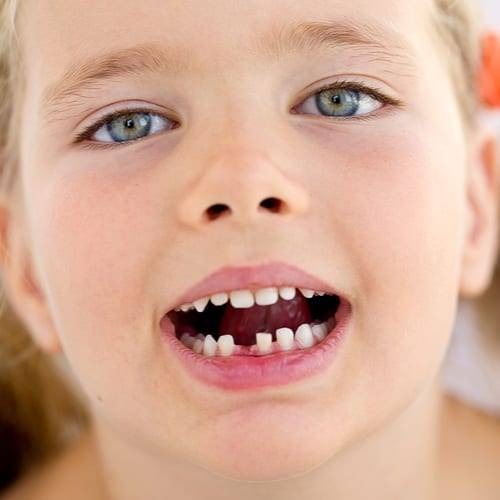 Child with Missing Tooth