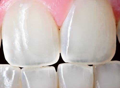 Teeth Close Up